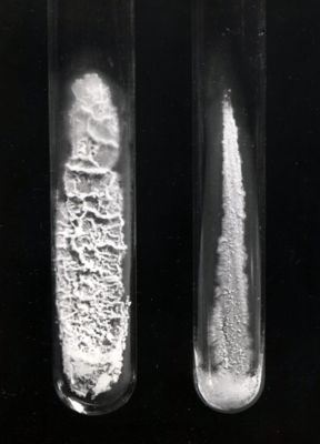 Patine S, R, coltura in agitazione, coltura in brodo di mucca viste al microscopio