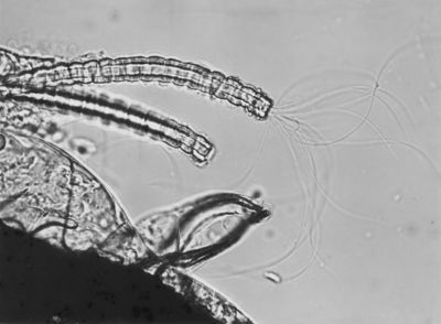 Parti di organi genitali di Musca domestica L. La mosca domestica è un insetto dell'ordine dei Ditteri, appartenente alla famiglia dei Muscidi