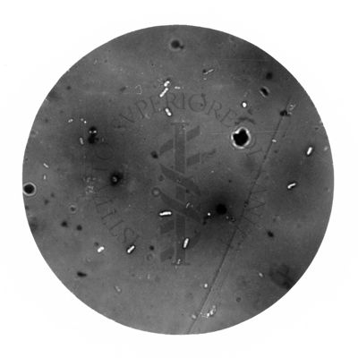 Rickettsia prowazekii e batteri comuni negli escrementi di pidocchi (cianochina)