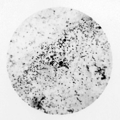 Rickettsia prowazekii coltivata nell'uovo fecondato (da un vaccino)