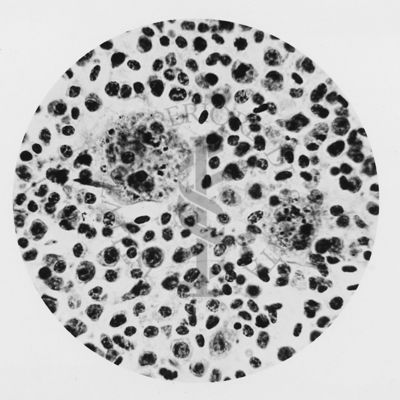 Plasmodium elongatum: cellule istiocitarie in fagocitosi