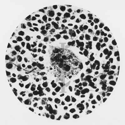 Plasmodium elongatum: cellule istiocitarie in fagocitosi