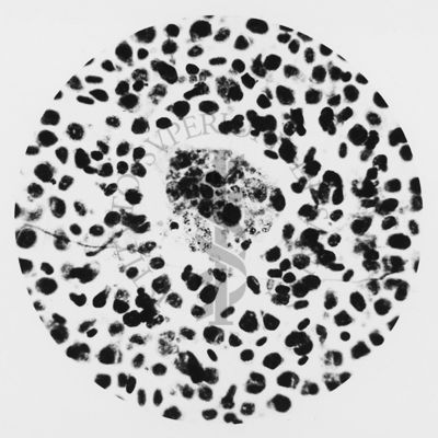 Plasmodium elongatum: cellule istiocitarie in fagocitosi