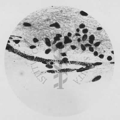 Plasmodium gallinaceum: capillari cerebrali forme endoiestiacitarie