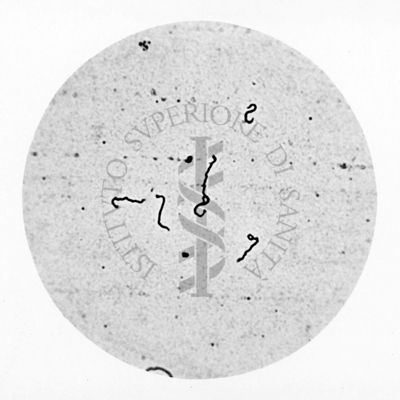 Leptospira ictero_haemorrhagiae forme brevi