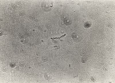 Differenti immagini del Batteriofago. Si tratta di un virus che infetta esclusivamente i batteri e sfrutta il loro apparato biosintetico per effettuare la replicazione virale.