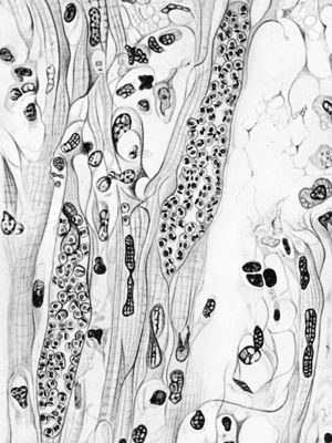 Trypanosoma cruzy: forme a Leishmania nel muscolo cardiaco umano