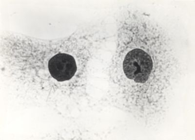 Diversi tipi di cellule da coltura