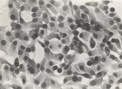 Cellule del fegato e tossina Clostridium cedematicus e histolyticum