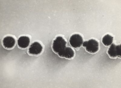 Fotografie di Corynebacterium diphtheriae