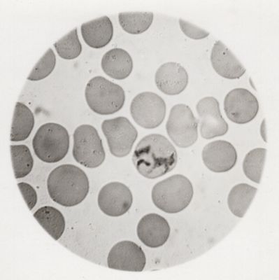 Schizonte di Plasmodium vivax in via di sviluppo