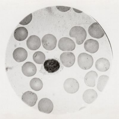 Microgametocito maturo di Plasmodium vivax