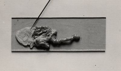 Gongylonema neoplasticum in stomaco di Mus rattus