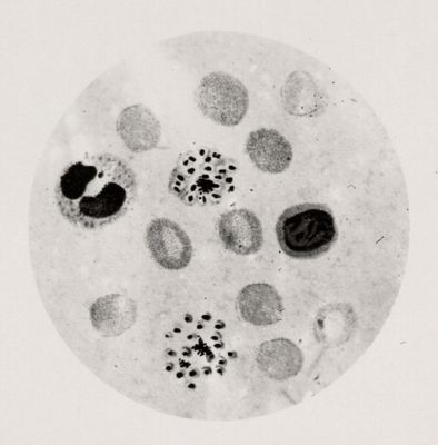 Plasmodium vivax: forma a rosetta, ciclo e schizonti