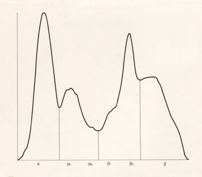 Tracciato elettroroforetico di sangue di ratto