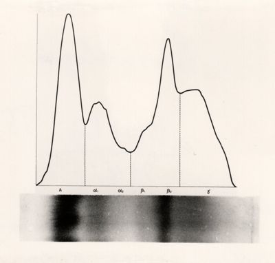 Stirscia e tracciato elettroforetico di sangue di ratto