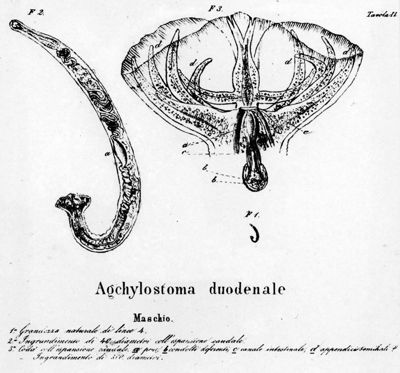 Lavoro e tavole originali di Angelo Dubini sull'Anchilostoma 1843