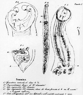Lavoro e tavole originali di Angelo Dubini sull'Anchilostoma 1843