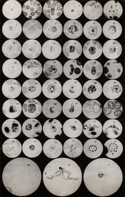 Serie di microfotografie indicanti i vari stadi di sviluppo dei parassiti malarigeni nell'uomo