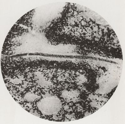 Larva di Anchylostoma nell'interno di un bronco