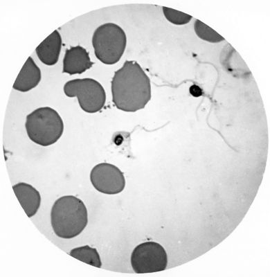 Trypanosoma gambiense - forme in distruzione