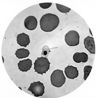 Trypanosoma gambiense - forme involute