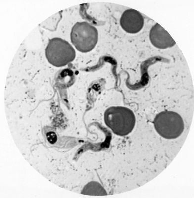 Trypanosoma gambiense - forme tipo B in fase di Crithidia