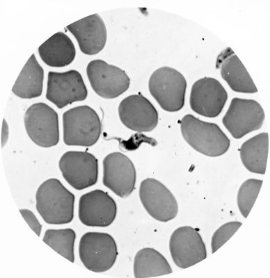 Trypanosoma gambiense - forma a Crithidia