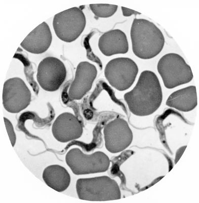 Trypanosoma gambiense - forme tipo A. e una tipo B.