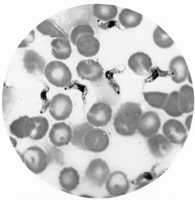 Trypanosoma gambiense - forme corte granulose