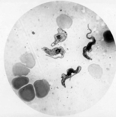 Trypanosoma gambiense - forme tipo A. e B.