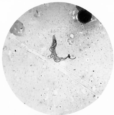 Trypanosoma gambiense - forma anucleata