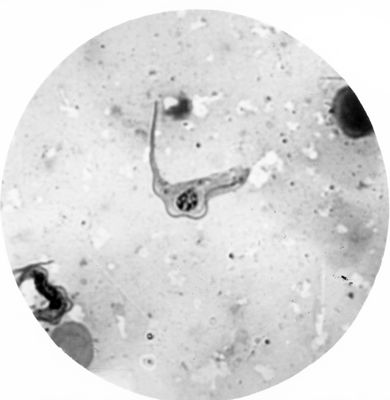 Trypanosoma gambiense - forme tipo B (elelmenti maschili?)