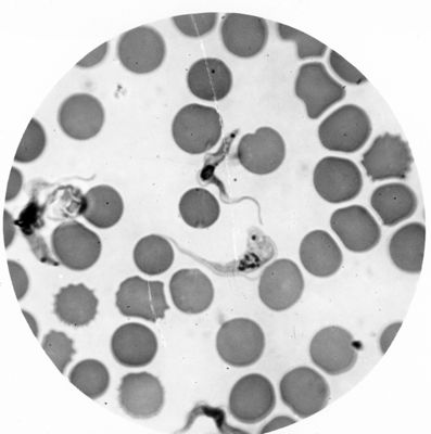 Trypanosoma gambiense - forme tipo B elelmenti maschili