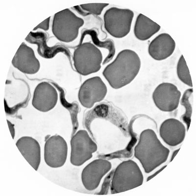 Trypanosoma gambiense - forma tipo B in divisione binaria