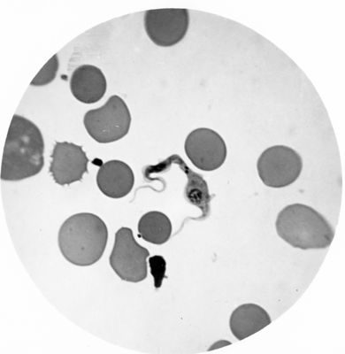 Trypanosoma gambiense - forma tipo A e tipo B in propabile singamia