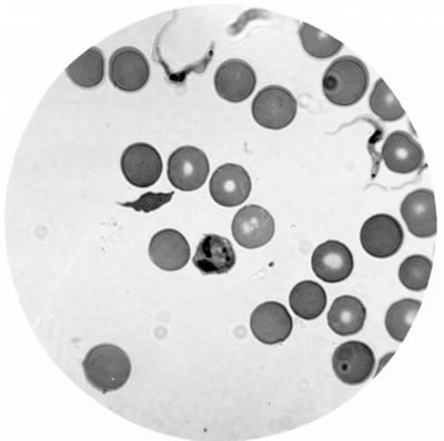 Trypanosoma gambiense - forme a Endotrypanum in fase endoglobulare