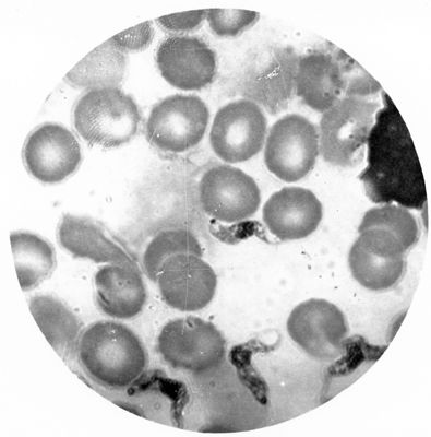 Trypanosoma gambiense - forma a Endotrypanum libera in circolo