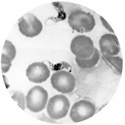 Trypanosoma gambiense - forma a Endotrypanum libera in circolo