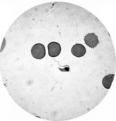 Trypanosoma gambiense - forma a Crithidia con etremità posteriore aguzza