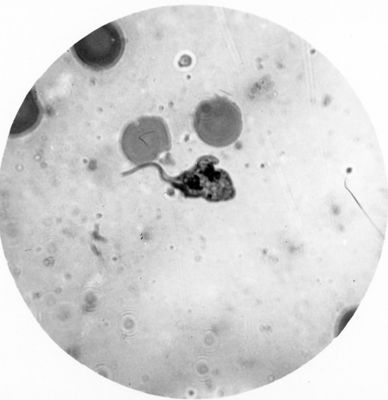 Trypanosoma gambiense - forma a Crithidia in divisione binaria