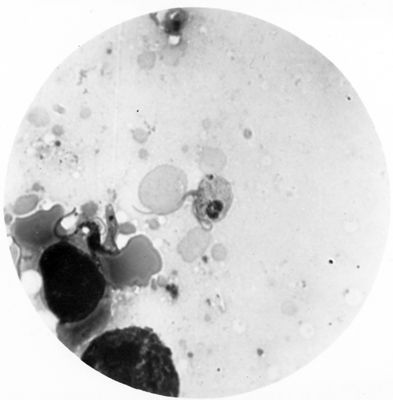 Trypanosoma gambiense - forma a Crithidia evolventi verso la fase a leptomonas