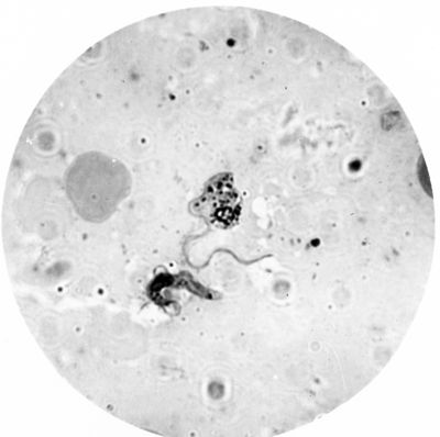 Trypanosoma gambiense - forma a Crithidia evolventi verso la fase a leptomonas