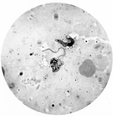 Trypanosoma gambiense - forme a Crithidia evolventi verso la fase a leptomonas