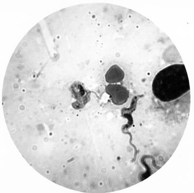 Trypanosoma gambiense - forme a Crithidia evolventi verso la fase a leptomonas