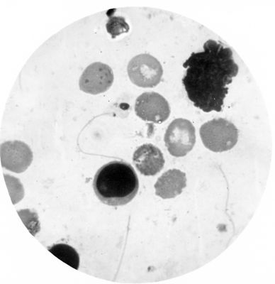 Trypanosoma gambiense - forma a leptomonas