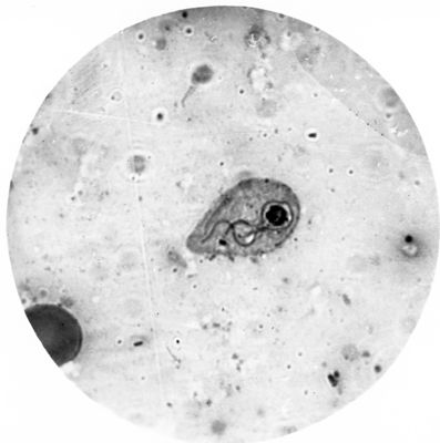 Trypanosoma gambiense - grossa forma a Leptomonas con flagello endocellulare