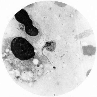 Trypanosoma gambiense - forma a petripanosomica  in iniziata divisione binaria