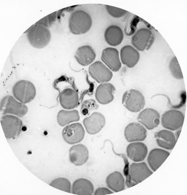 Trypanosoma gambiense - forma a Leishmania nel sangue circolante