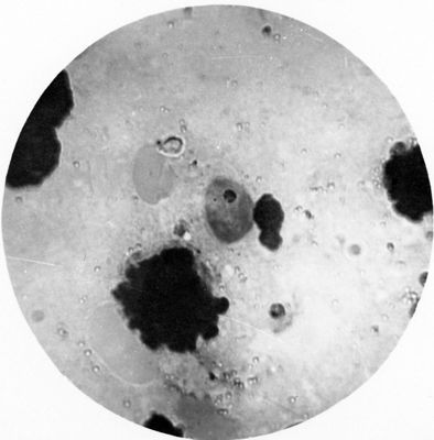 Trypanosoma gambiense - grossa forma a Leishmania che probabilmente si prepara a dividersi